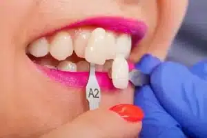 How to Use Porcelain Veneers to Fix Your Smile